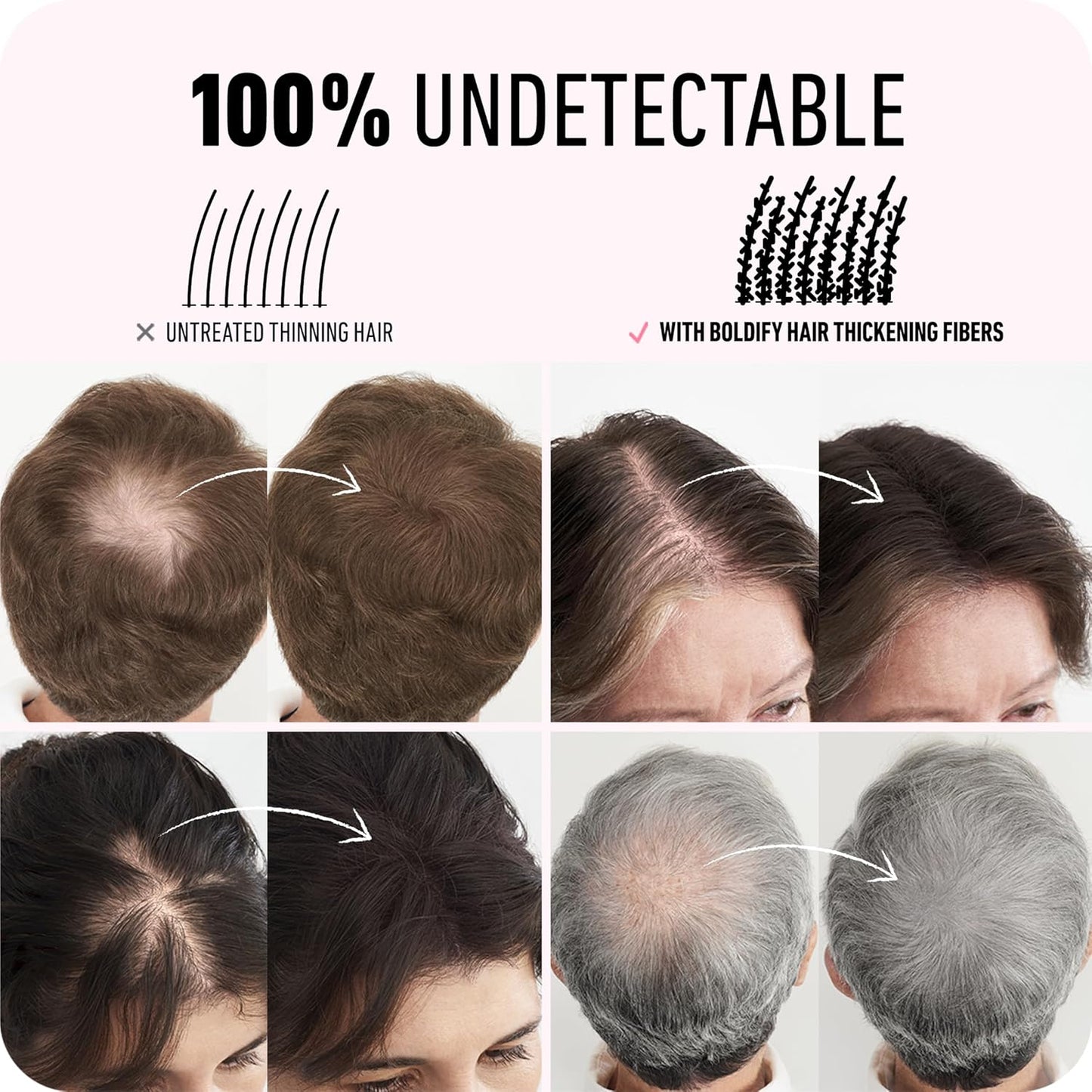 BOLDIFY Hair Fibers (12g) - Fill In Thinning and Fine Hair for an Instantly Fuller, Thicker Look - 14 Shades for Women & Men - Medium Brown