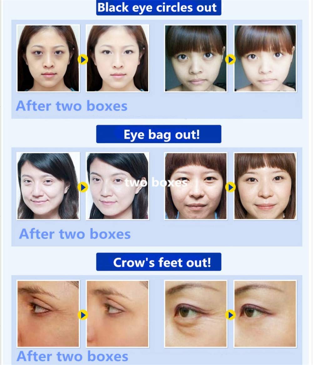 Adofect 30 Pairs Pink Eye Mask Collagen Eye Gel Pads Under Eye Patches Mask for Puffiness and Dark Circle Under Eye Patches for Women and Men