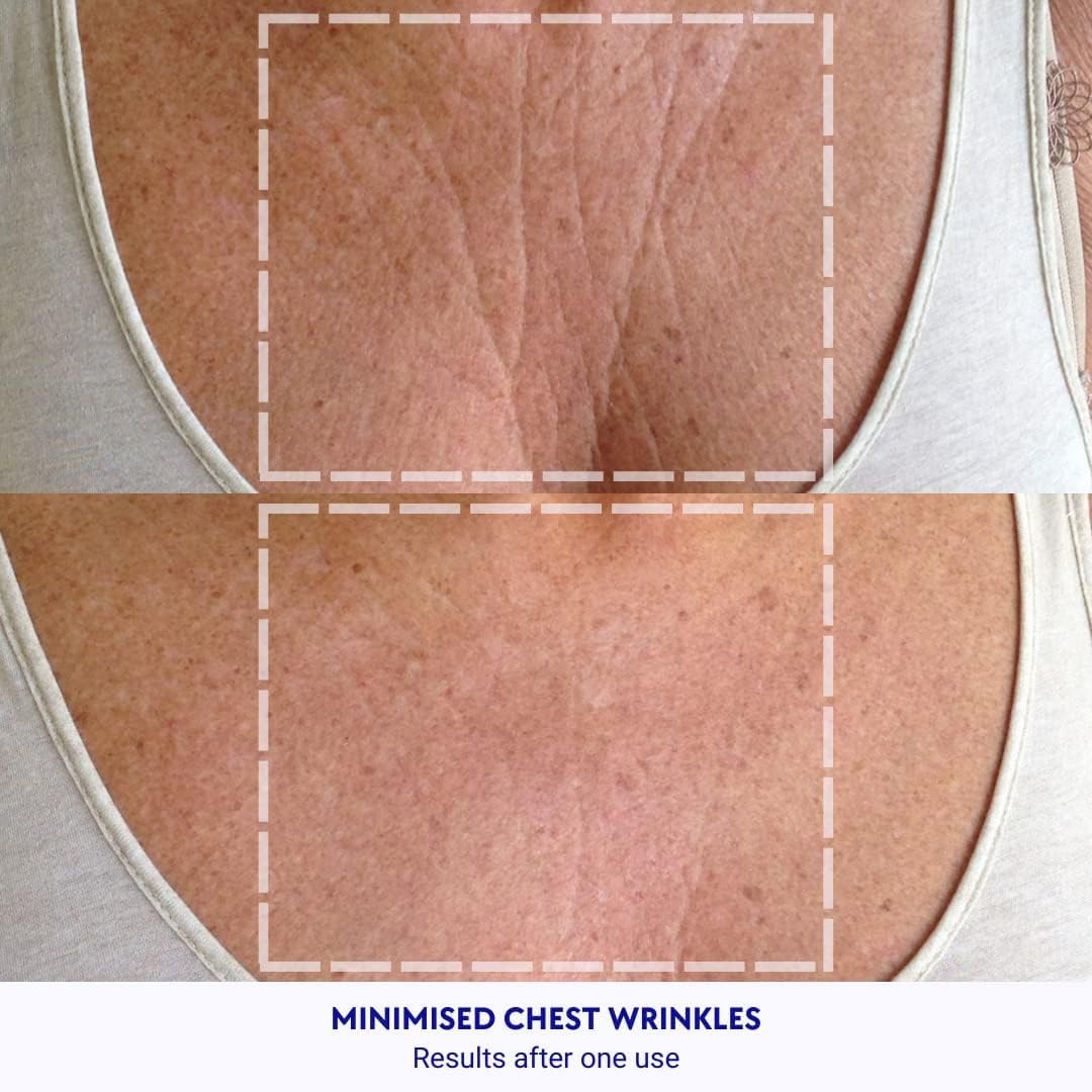 Wrinkles Schminkles Chest Wrinkle Patch & Cleanser Starter Pack - Set of Reusable Chest Silicone Wrinkle Patch + Patch Cleanser (2 oz) Maximise Uses - Smooth & Prevent Chest & Décolletage Wrinkles